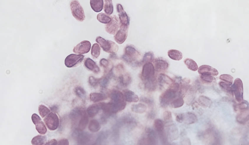 Macella Bacteria Diagram
